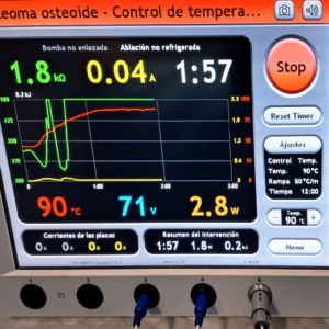 impedancia alcanzada durante el tratamiento